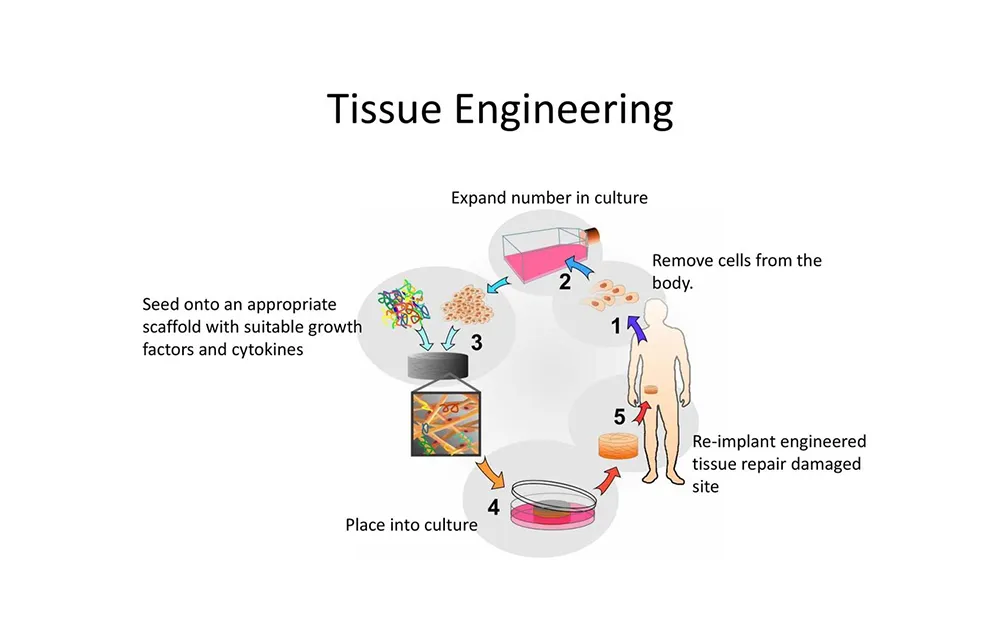 Diagram of tissue engineering steps