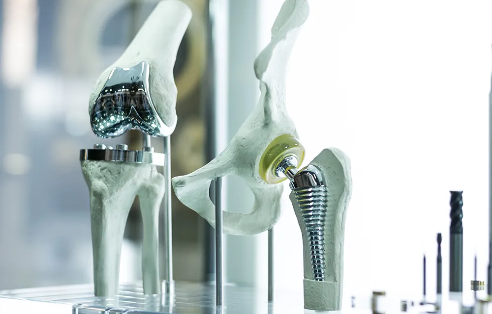 Orthopaedic implants